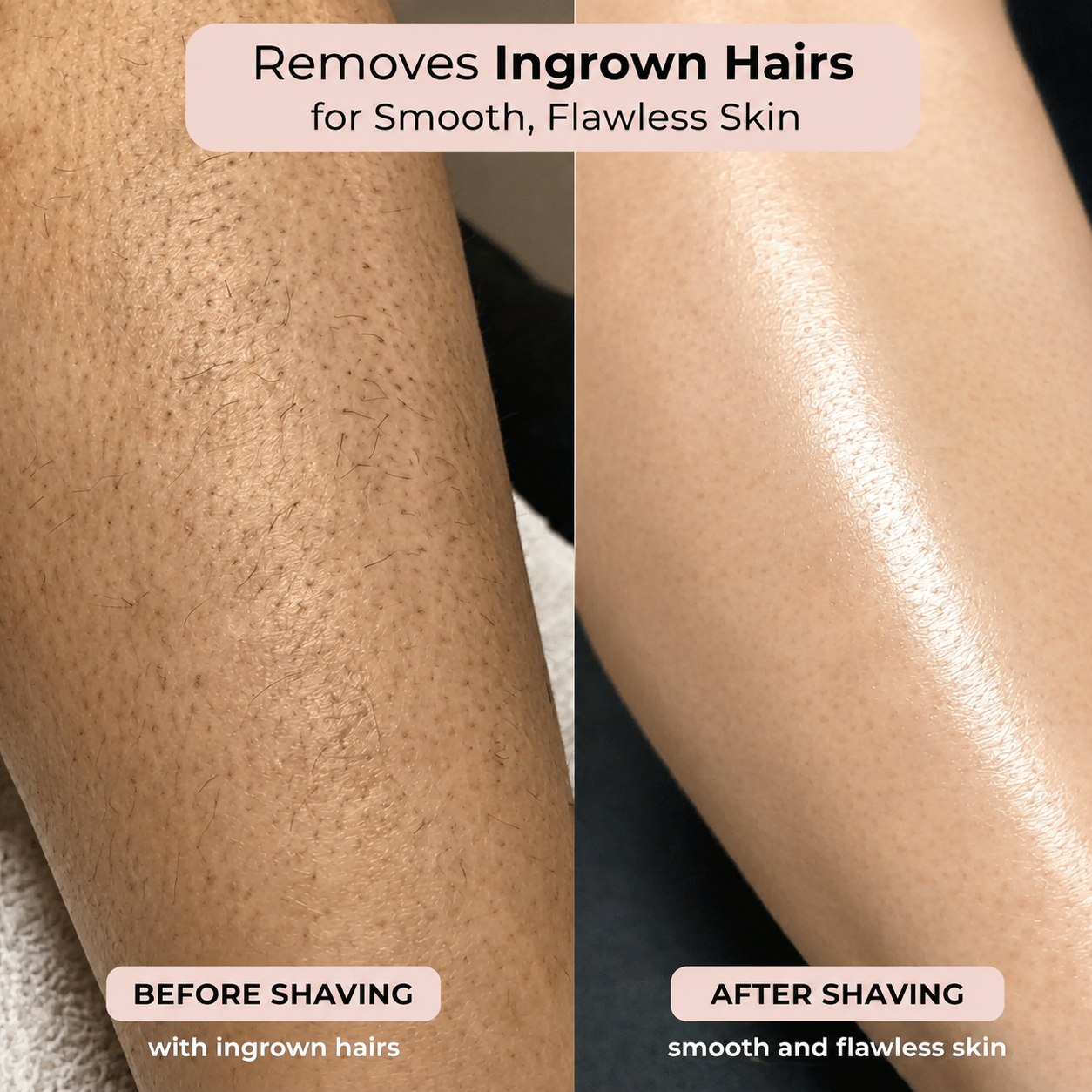 HoTo™ 2-in-1 Bikini and Body Shaver