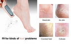 HoTo™ Callus Remover