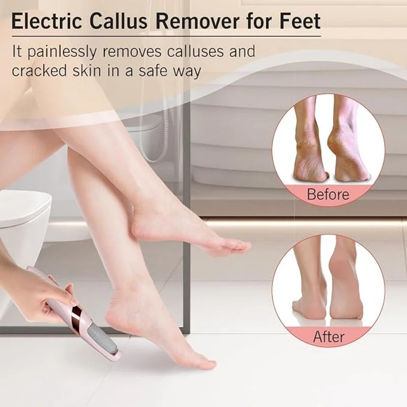 HoTo™ Callus Remover